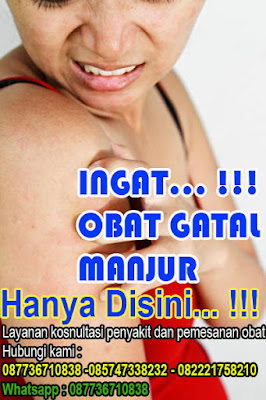 Obat gatal selangkangan paling ampuh di apotik Obat gatal selangkangan paling ampuh di apotik